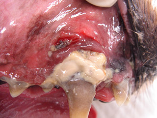 犬歯の根尖膿瘍から歯肉に瘻孔ができた症例